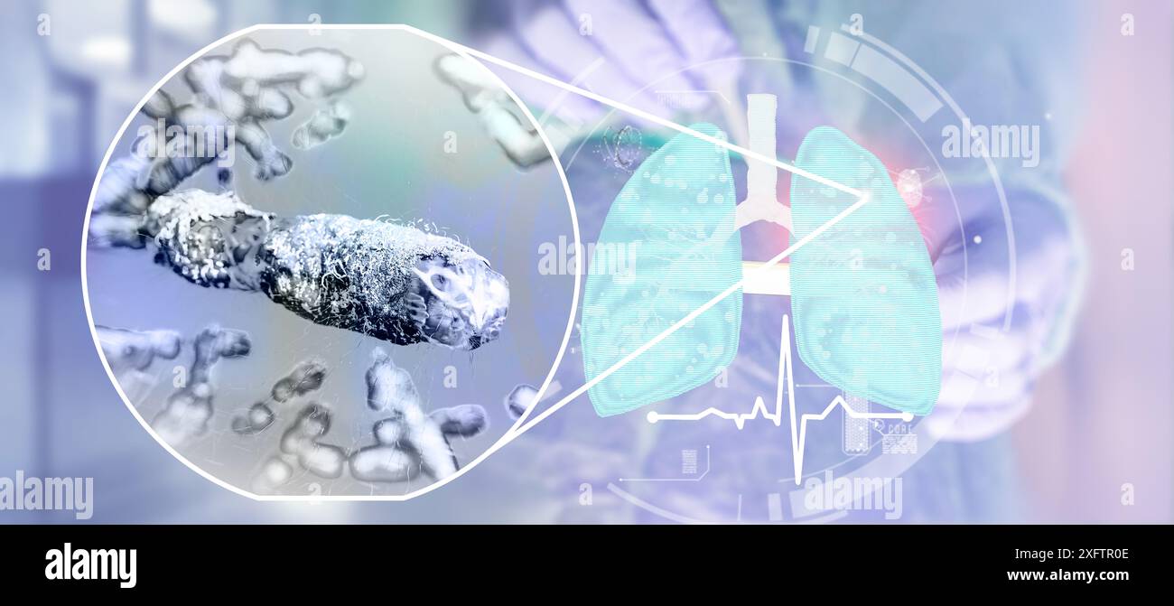 Concept des poumons infectés par la main du médecin, présence d'infection à mycobactéries tuberculeuses, tuberculose bactérienne, cancer du poumon et maladie pulmonaire Banque D'Images