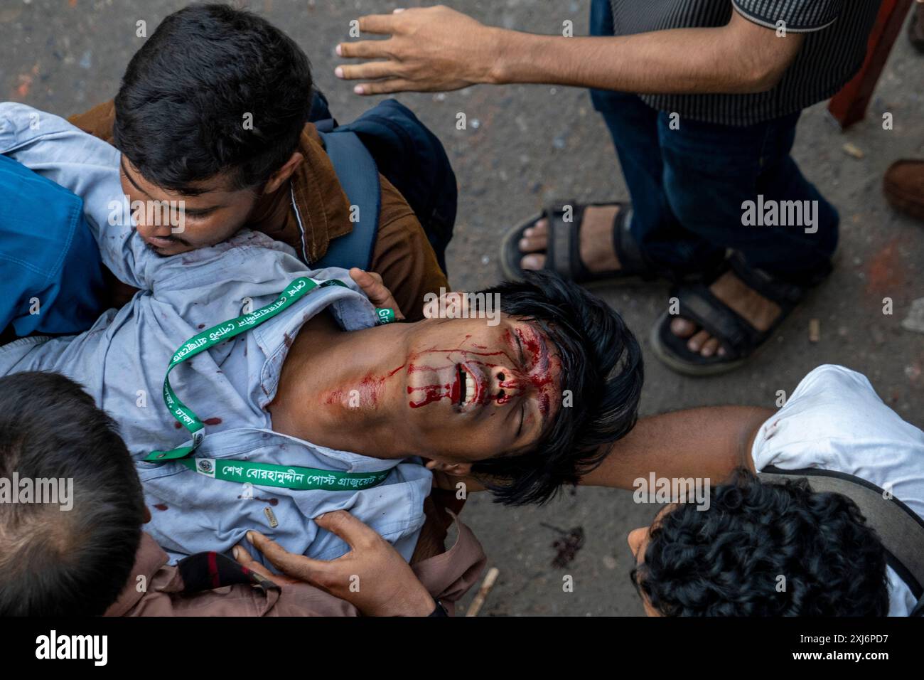 Dhaka, Bangladesh. 16 juillet 2024. Un étudiant est blessé lors d'un affrontement entre des militants de la réforme des quotas et des étudiants soutenant le parti au pouvoir, la Ligue Awami, au Science Lab de Dhaka. Au moins six personnes ont été tuées à Dhaka, Chittagong et Rangpur et plusieurs centaines ont été blessées. La police et les membres au pouvoir de la Ligue Awami ont affronté les militants de la réforme des quotas pour la deuxième journée. (Photo par Sultan Mahmud Mukut/SOPA images/SIPA USA) crédit : SIPA US/Alamy Live News Banque D'Images