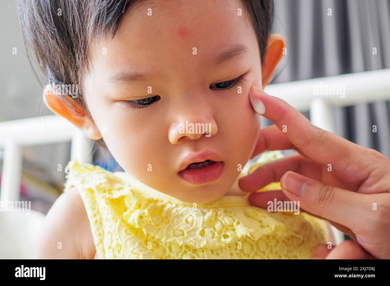 mère appliquant la crème de médecine antiallergique au visage mignon de fille asiatique avec éruption cutanée et allergie avec tache rouge cause par piqûre de moustique Banque D'Images