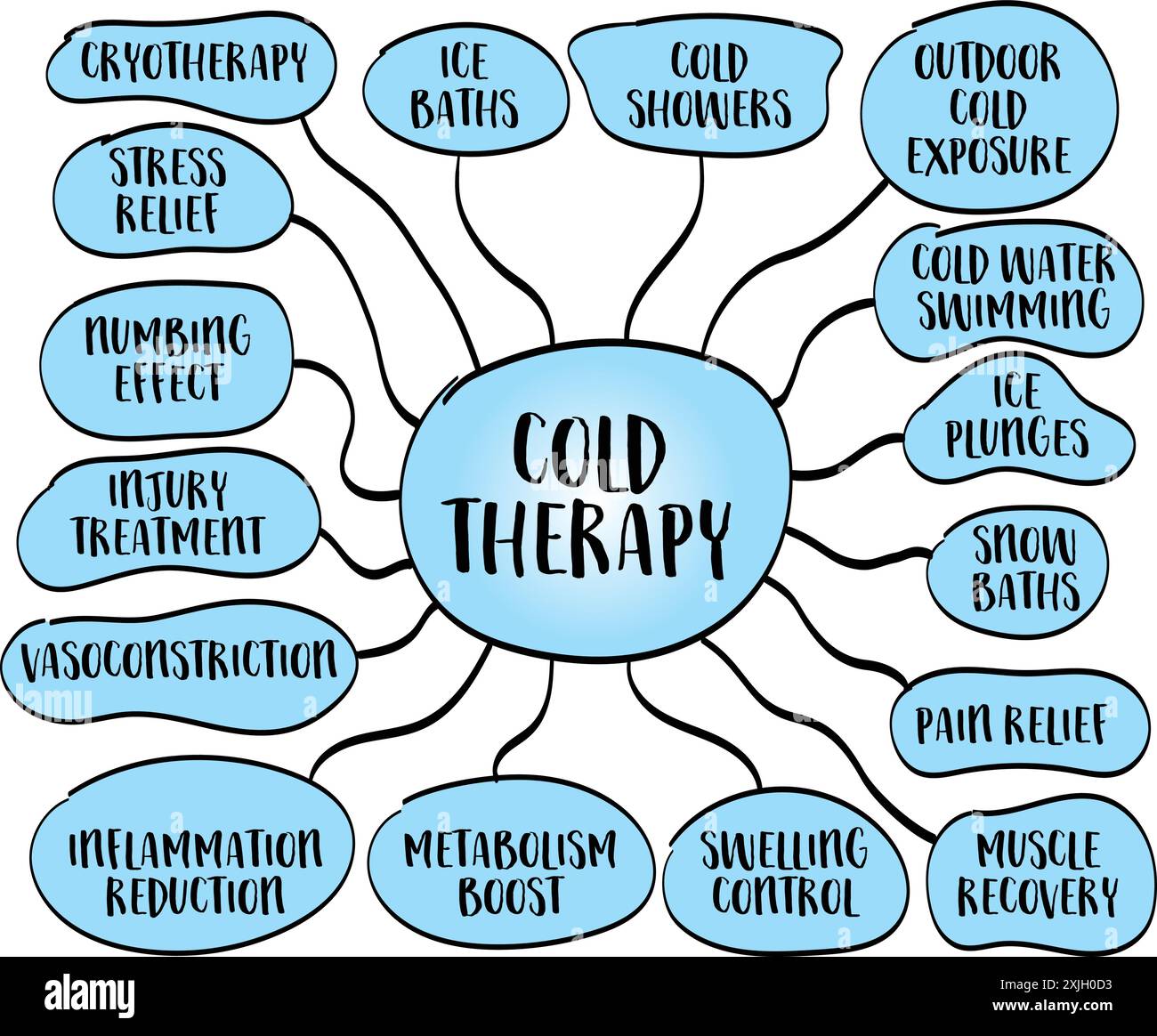 infographie de thérapie froide, concept de santé, croquis de carte mentale vectorielle Illustration de Vecteur