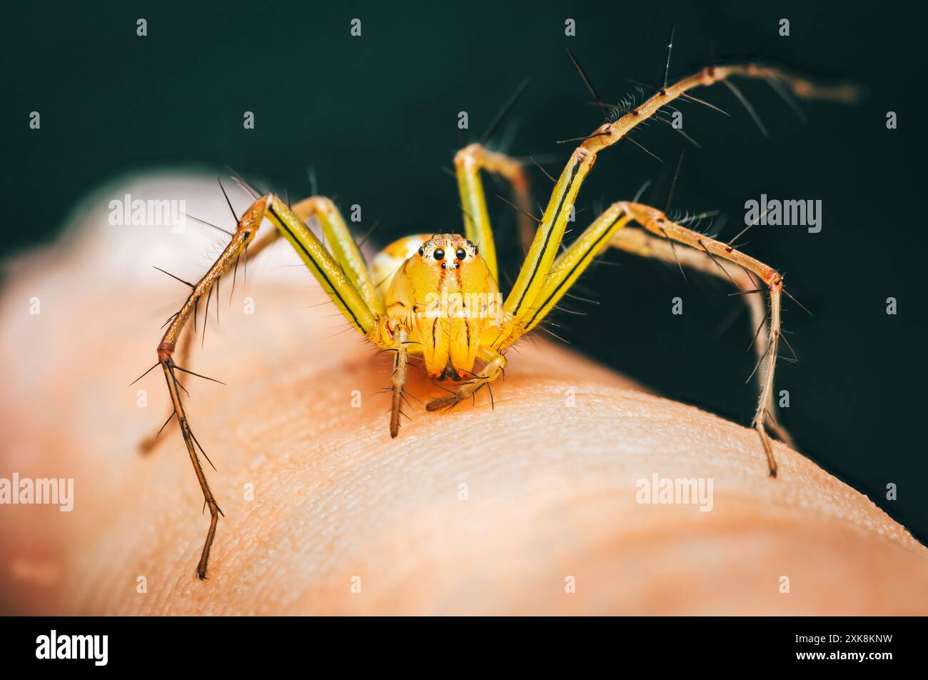 Araignée Lynx rayée jaune sur la peau humaine, gros plan de la photo d'insecte. Banque D'Images