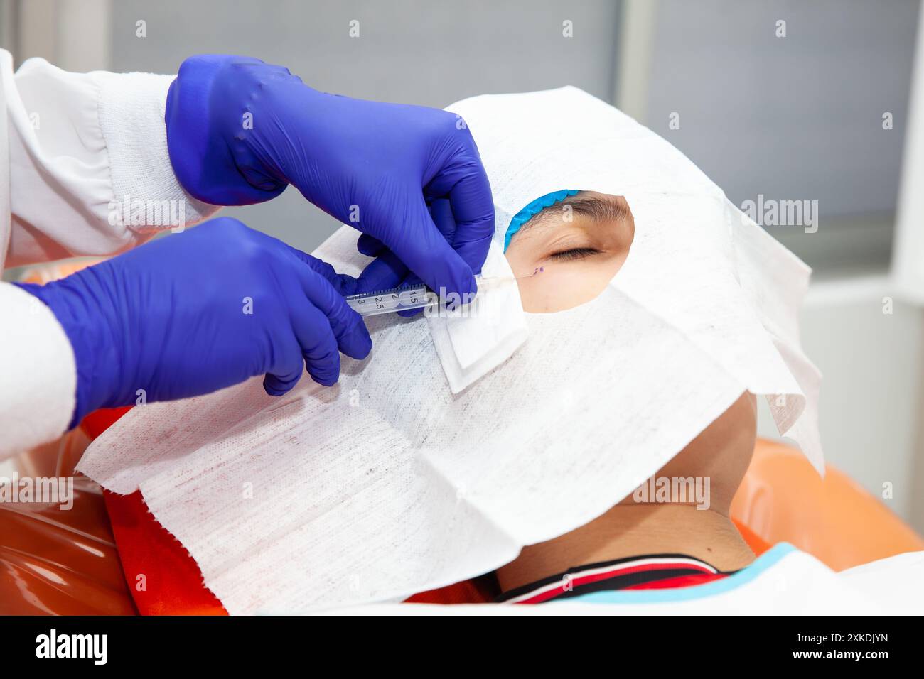 Procédé d'exérèse d'une lésion cutanée. Dermatologue réalisant une ablation d'une lésion cutanée bénigne sur le visage d'un jeune homme. Banque D'Images