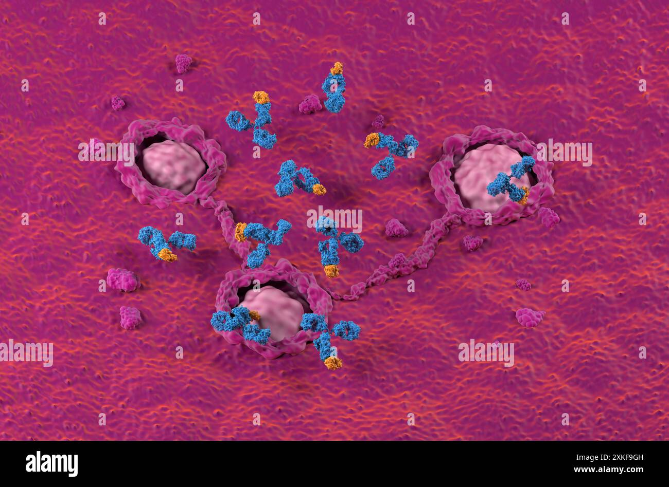 Traitement par anticorps monoclonaux dans le côlon, cancer colorectal (CRC) - vue isométrique illustration 3D. Banque D'Images