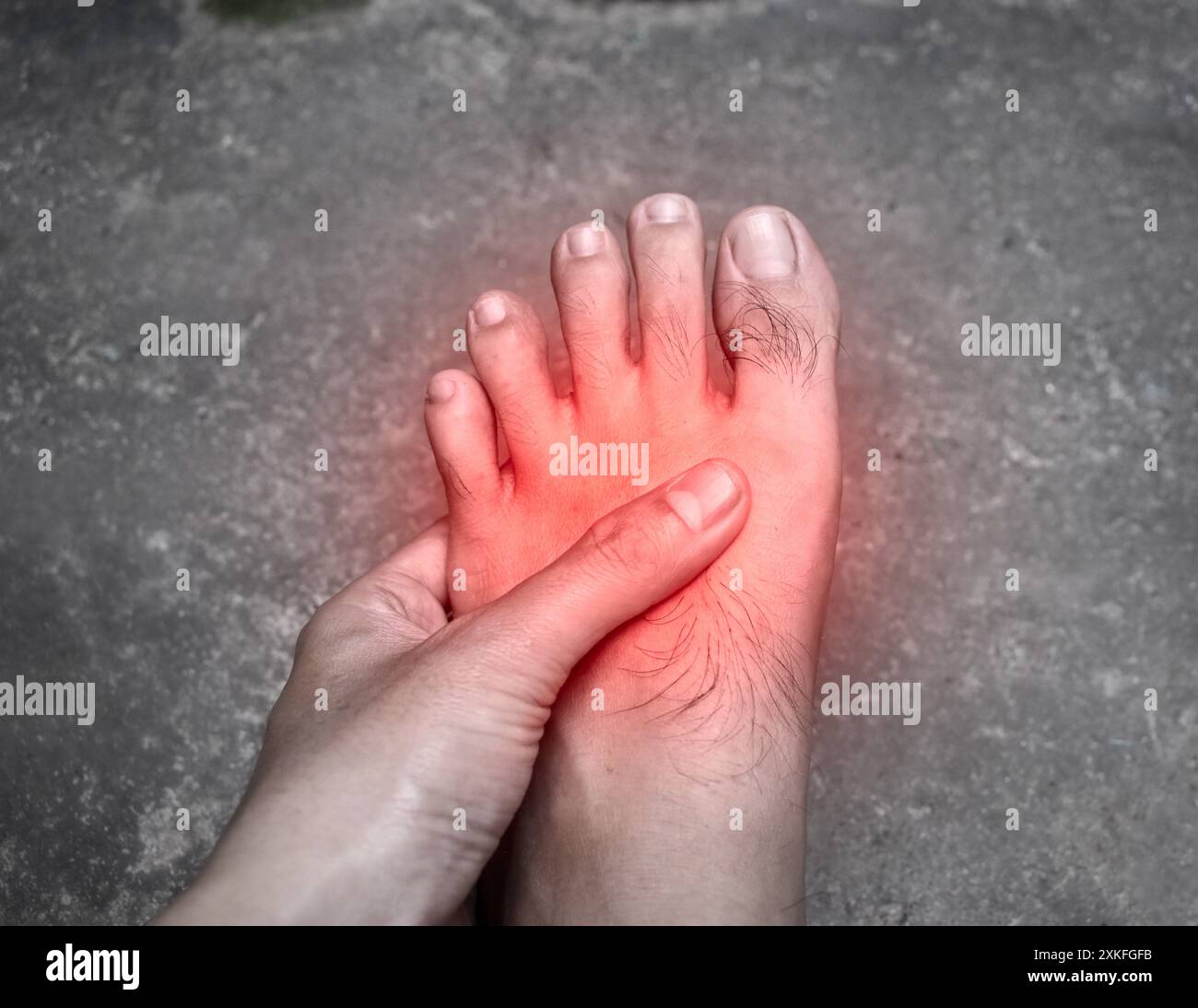 Pied douloureux du jeune homme asiatique avec le diabète.Problèmes de neuropathie sensorielle.Problèmes de nerfs des pieds. Banque D'Images