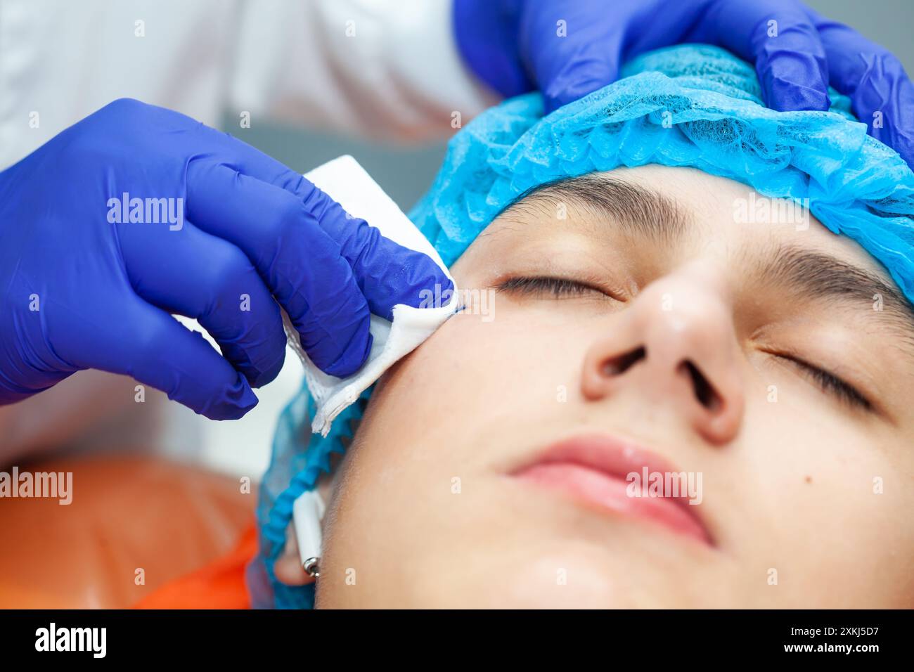 Gros plan sur le visage d'un jeune homme après exérèse d'une lésion cutanée bénigne au cabinet d'un dermatologue. Banque D'Images