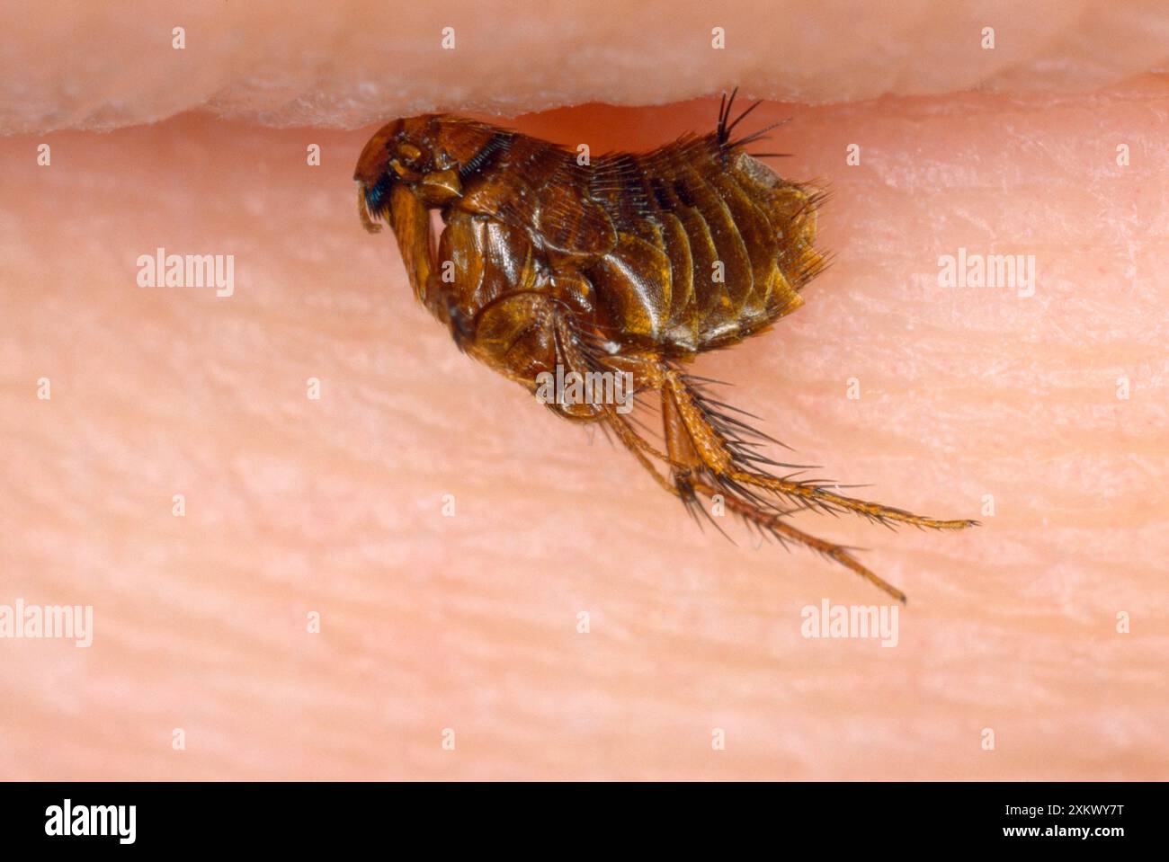 Mole Flea - sur la peau humaine Banque D'Images