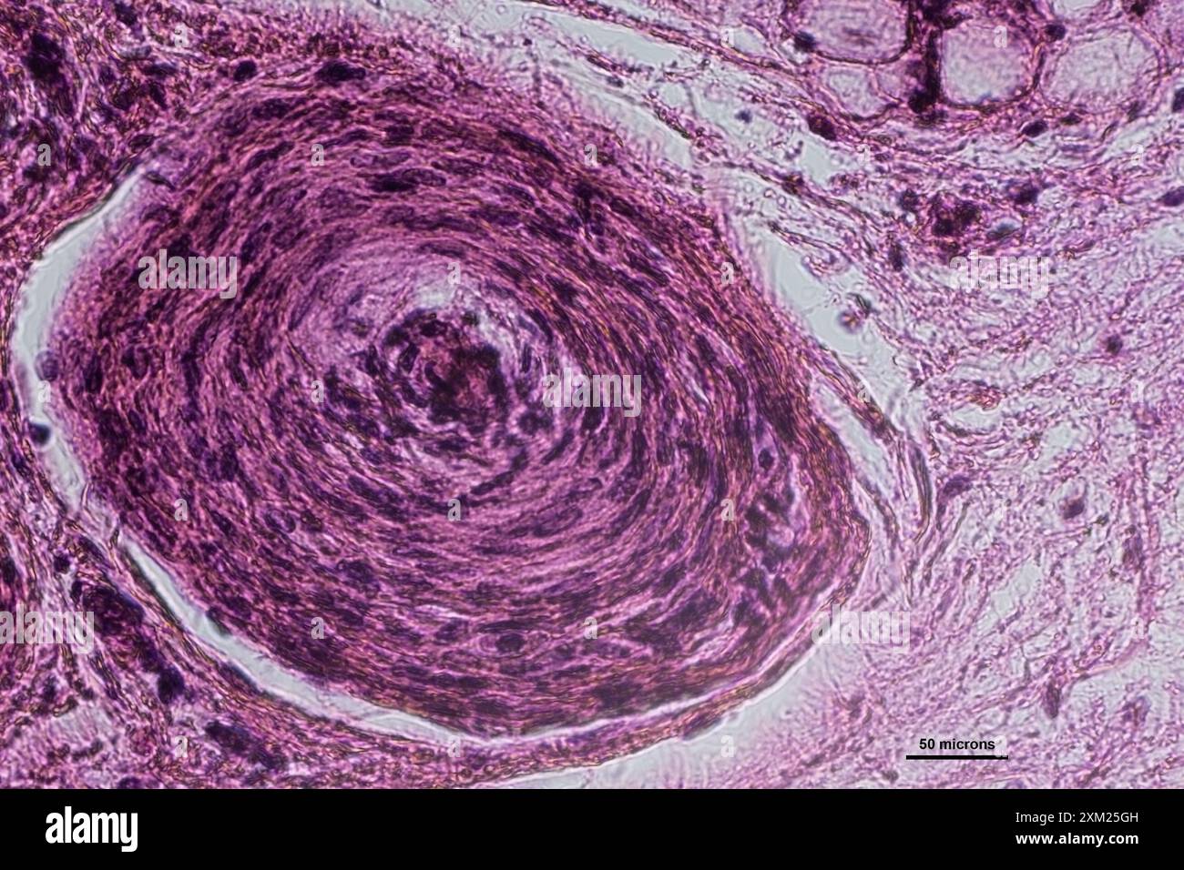 Micrographie de la coupe verticale du corpuscule pacinien à 40 tie grossissement Banque D'Images