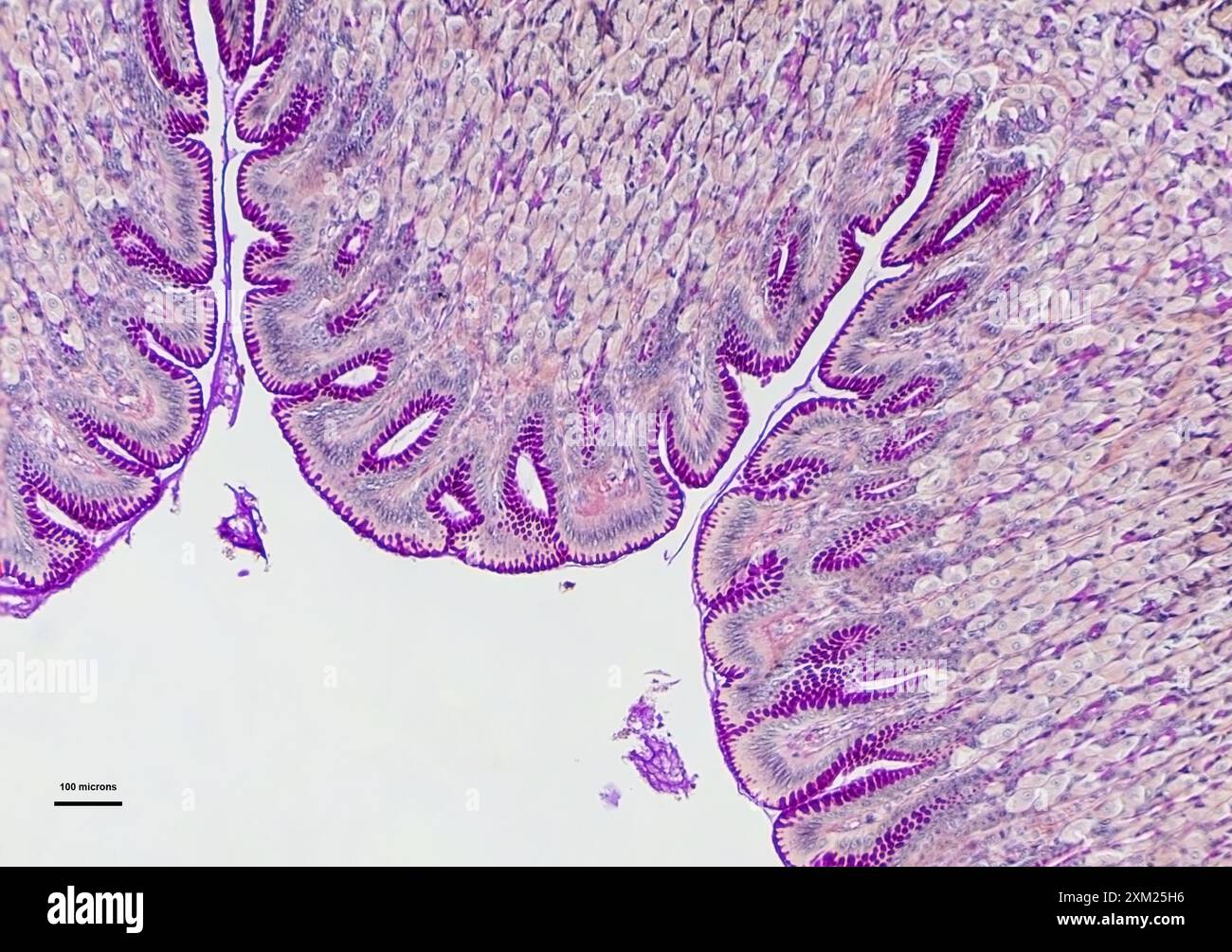 micrographie des cellules de l'estomac sous à 10 fois grossissement Banque D'Images