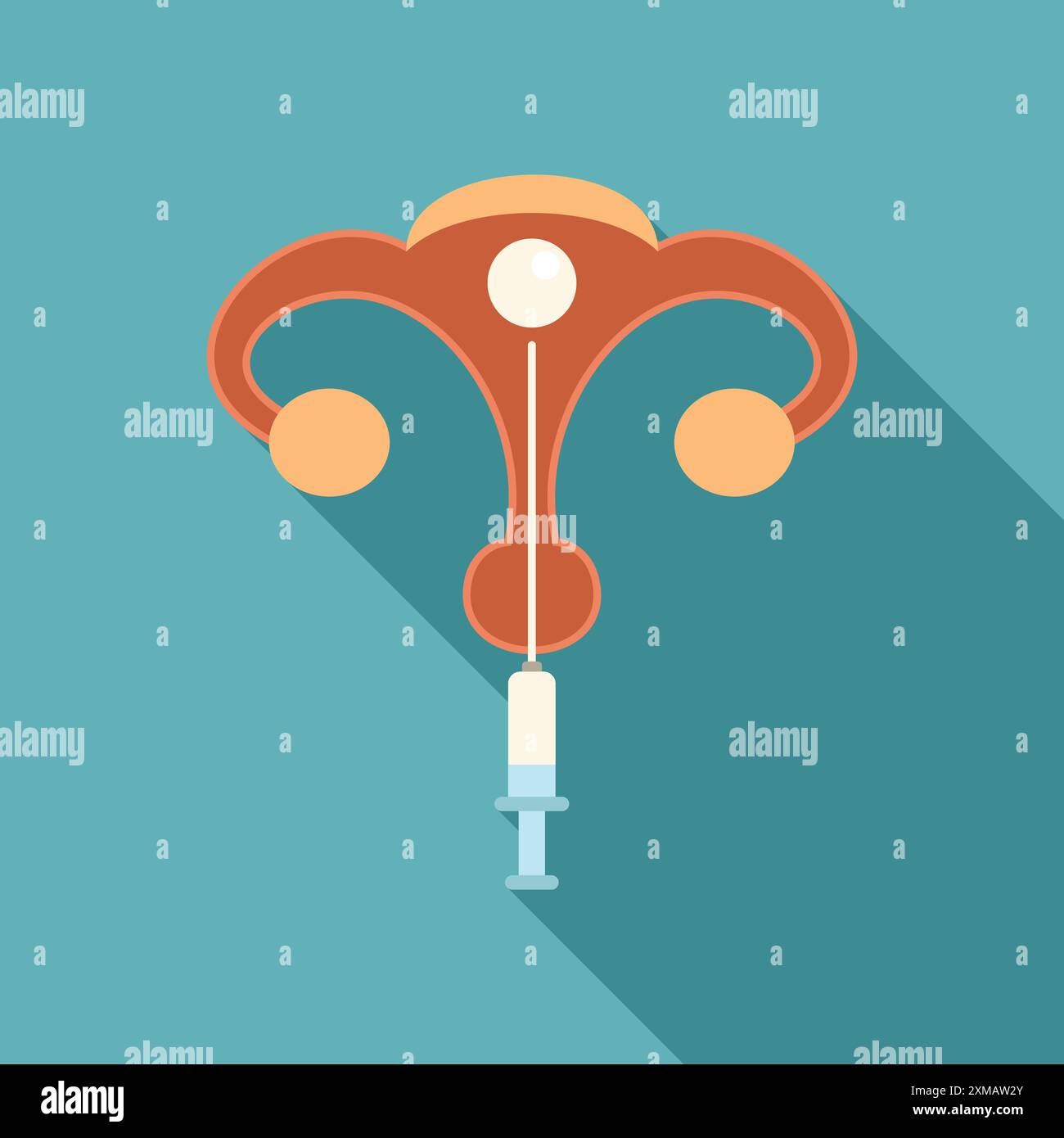 Illustration représentant le système reproducteur masculin recevant un traitement directement dans la prostate avec une injection par seringue Illustration de Vecteur