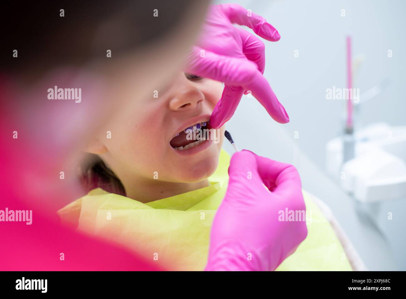 Dentiste appliquant une solution révélatrice de plaque dentaire sur les dents de l'enfant Banque D'Images