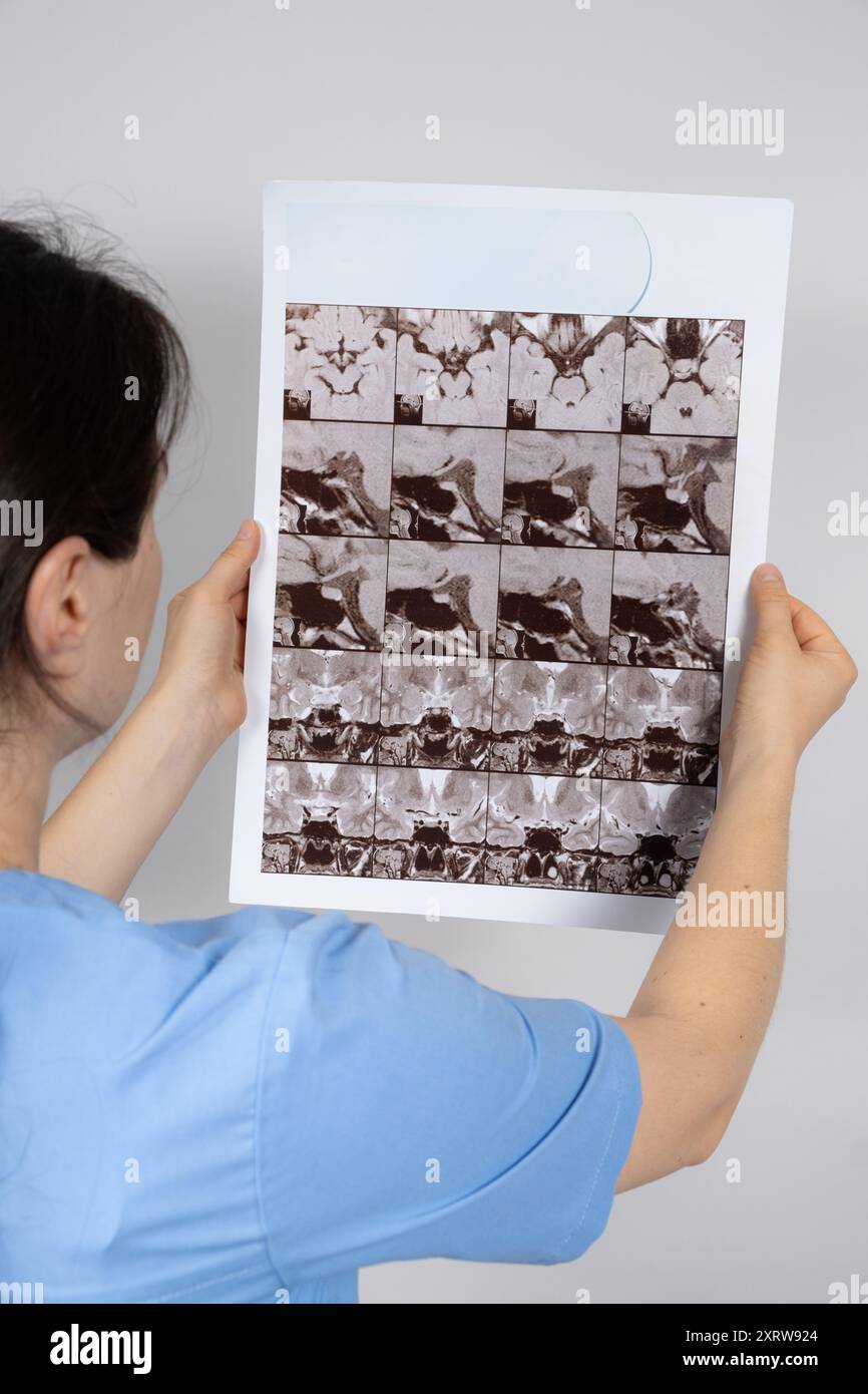 Le médecin détient une image IRM de l'hypophyse d'une personne en bonne santé. Banque D'Images