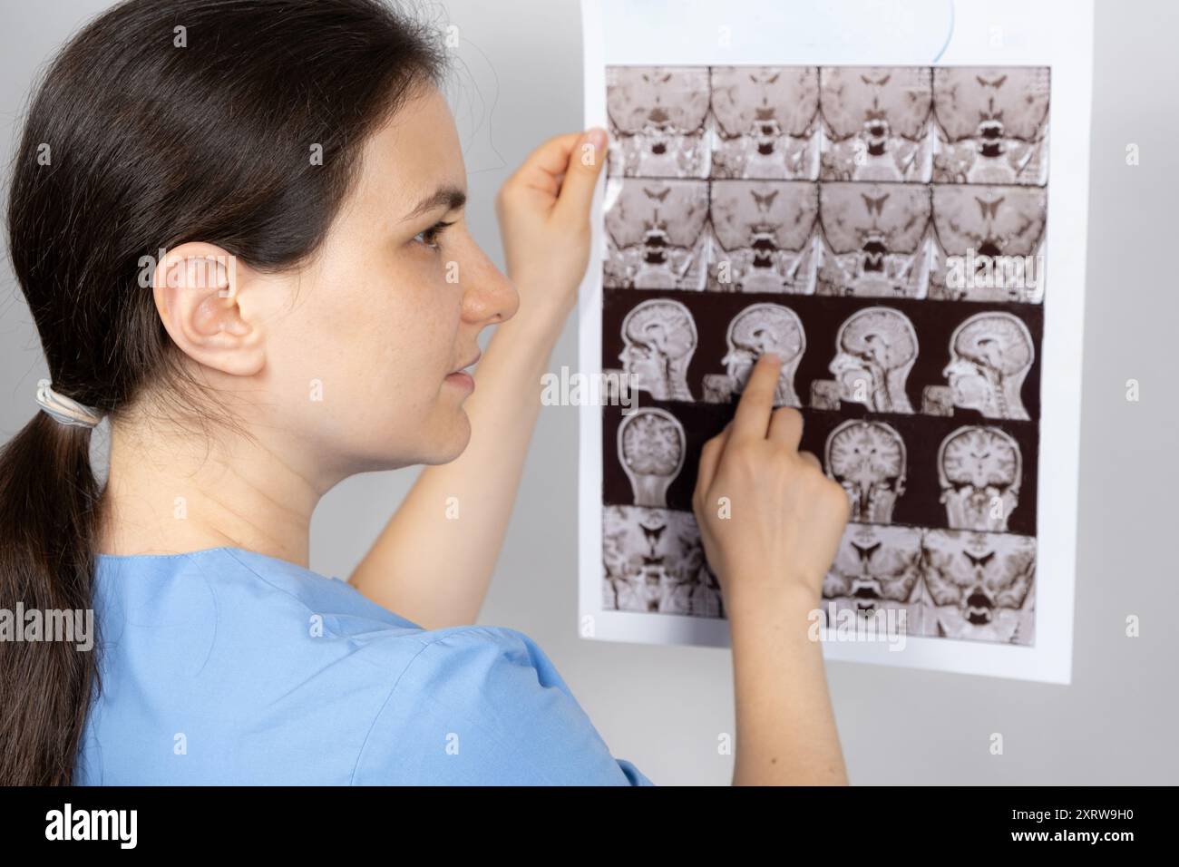 Le médecin détient une image IRM de l'hypophyse d'une personne en bonne santé. Banque D'Images