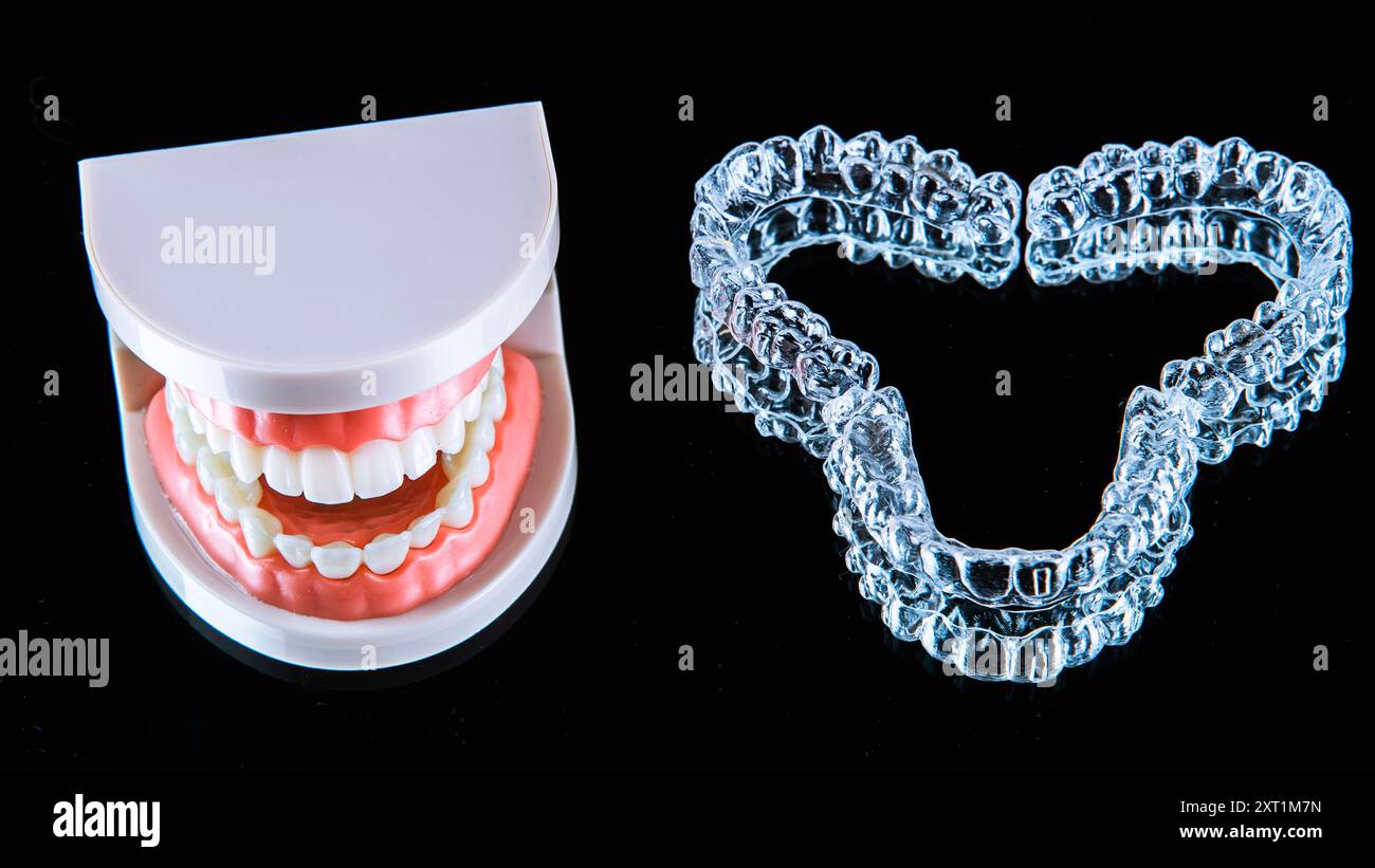 Gros plan. Les aligneurs transparents pour dents de mâchoire artificielles reposent sur un miroir sur un fond noir Banque D'Images