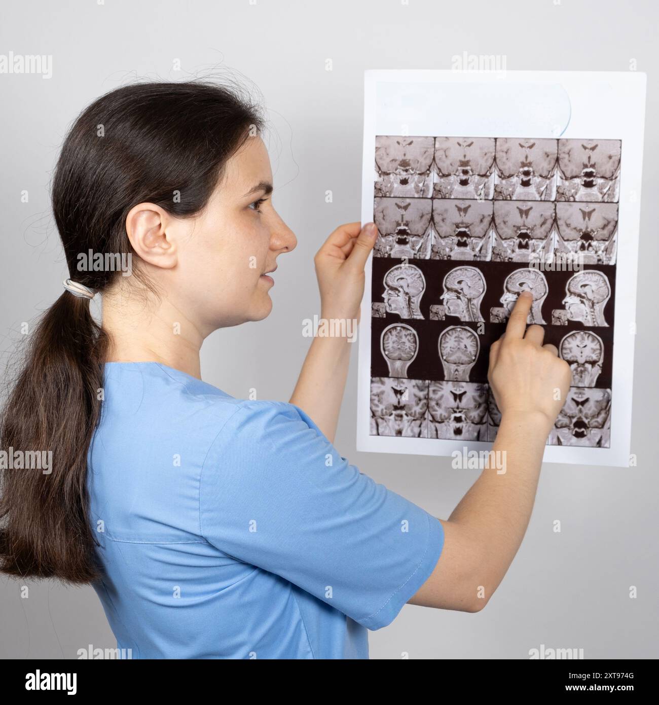 Le médecin détient une image IRM de l'hypophyse d'une personne en bonne santé. Banque D'Images