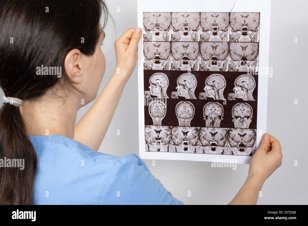 Le médecin détient une image IRM de l'hypophyse d'une personne en bonne santé. Banque D'Images