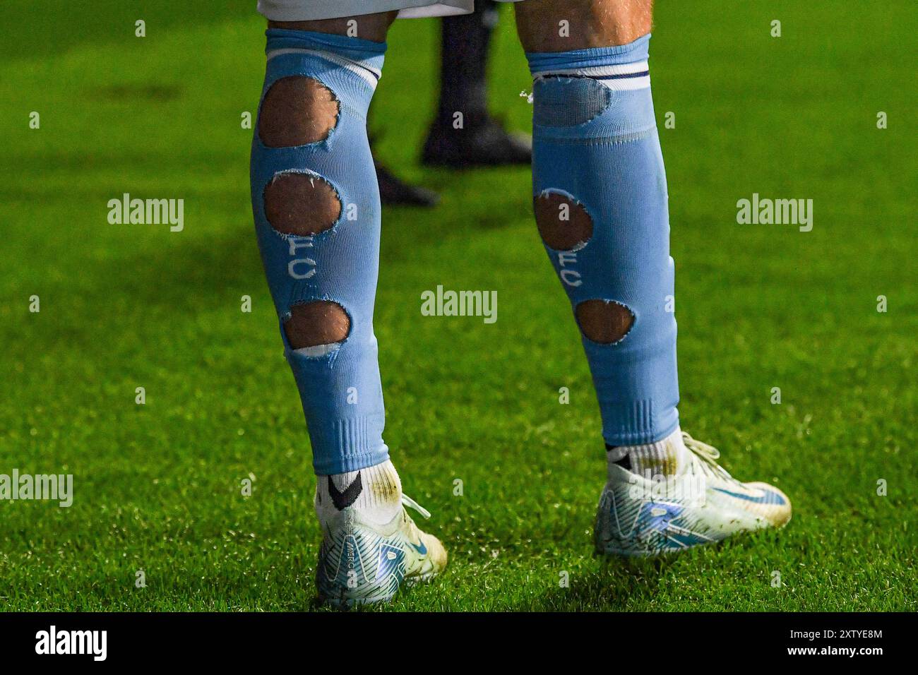 16 août 2024 ; Coventry Building Society Arena, Coventry, Angleterre ; EFL Championship, Coventry City versus Oxford United ; chaussettes coupées pour éviter les crampes crédit : action plus Sports images/Alamy Live News Banque D'Images