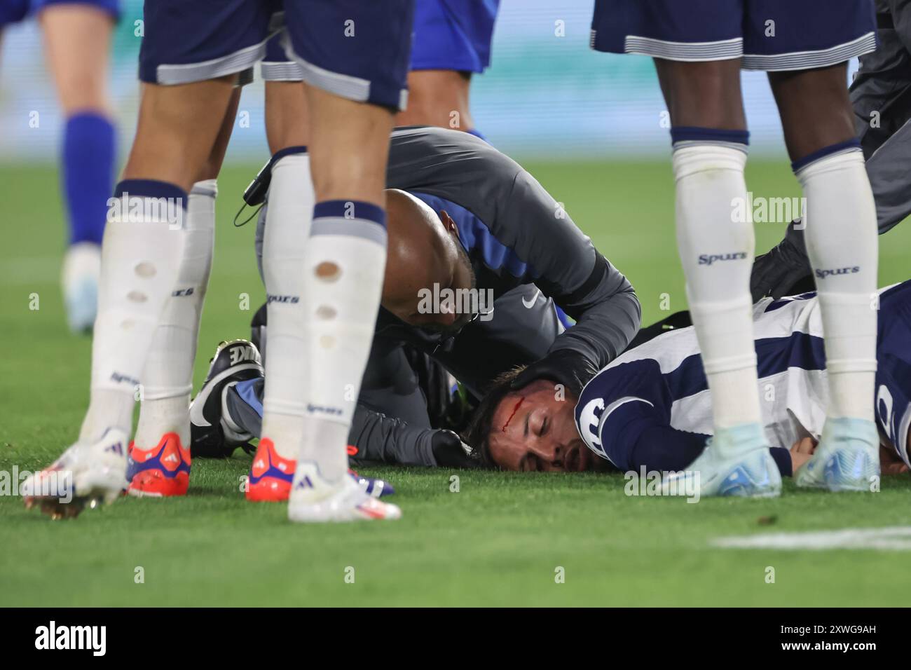 ***NOTE DES RÉDACTEURS CONENT GRAPHIQUE*** Rodrigo Bentancur de Tottenham Hotspur tombe blessé lors du match de premier League Leicester City vs Tottenham Hotspur au King Power Stadium, Leicester, Royaume-Uni, 19 août 2024 (photo de Mark Cosgrove/News images) Banque D'Images