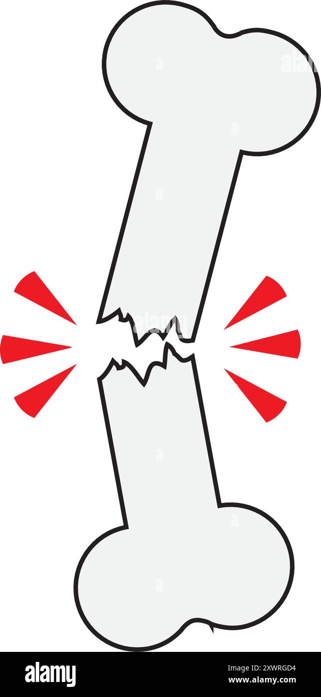 Icône de ligne osseuse brisée simple. Conception d'illustration vectorielle de symbole et de signe. Contour modifiable. Isolé sur fond blanc Illustration de Vecteur