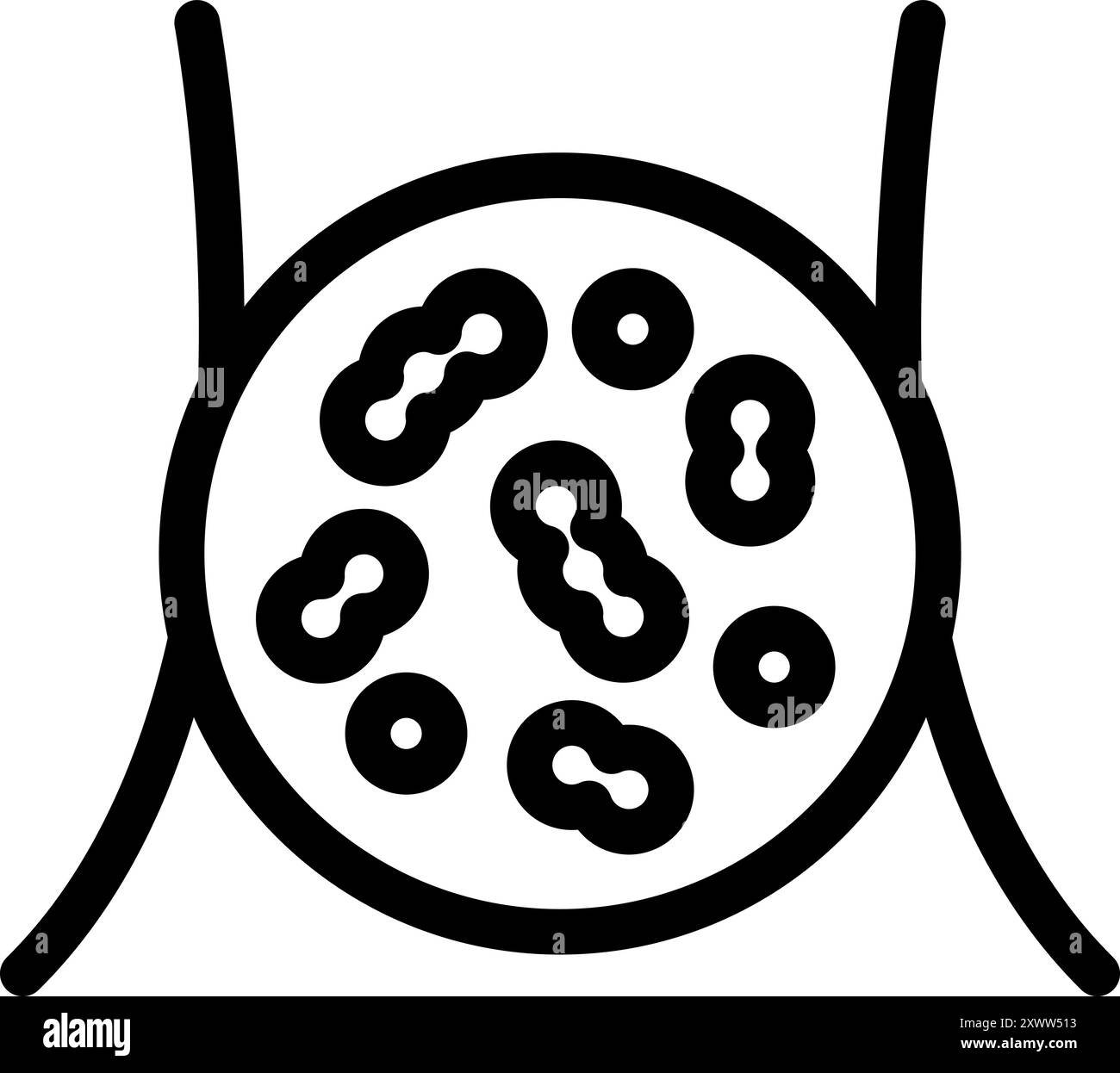 Ganglion lymphatique contenant des bactéries montrant le système lymphatique Illustration de Vecteur