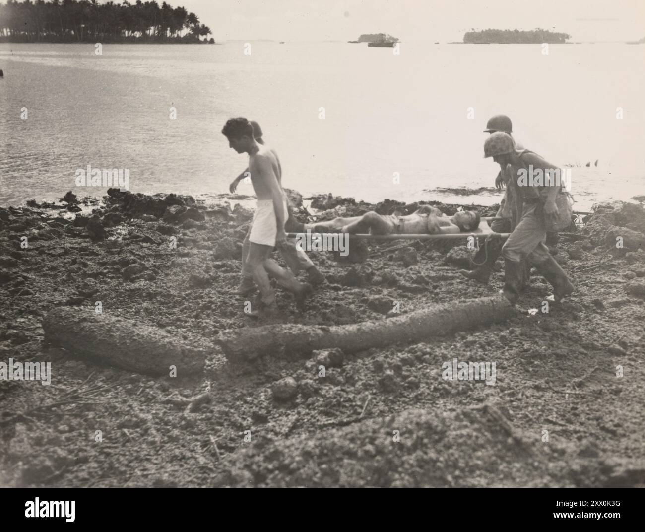 Débarquements de la guerre mondiale sur Rendova. Fait partie de la campagne de Nouvelle-Géorgie. Juin - juillet 1943. Des Marines d'un bataillon de défense transportant un ami blessé d'une position de repérage après qu'il ait été blessé par des coraux volants lors d'un raid de bombardiers en piqué japonais. La seule victime, le Cpl James E. Burns, USMC, de Bethel, Connecticut (sur le brancard). Banque D'Images