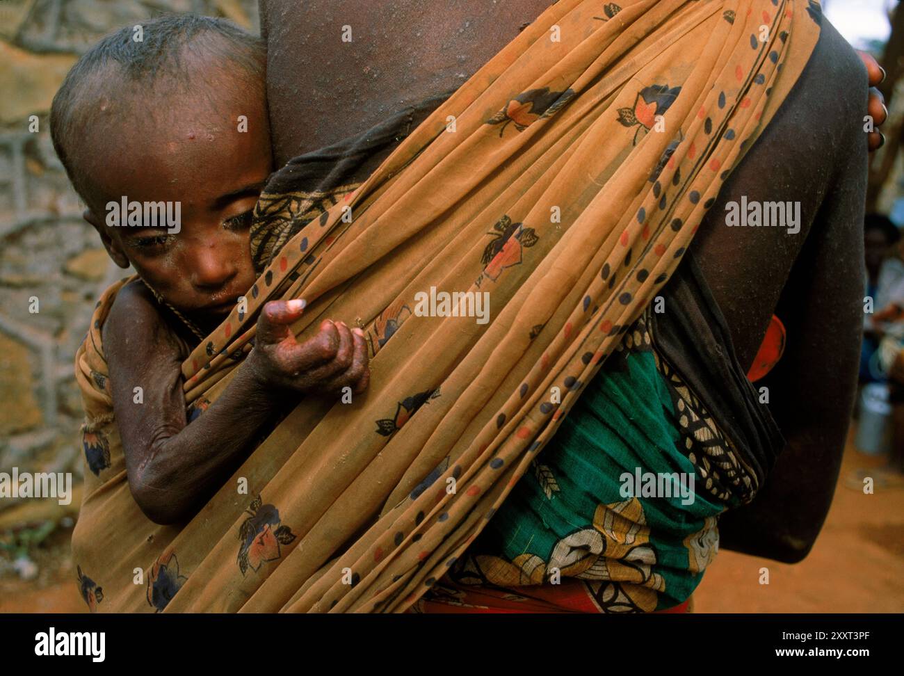 Un enfant gravement sous-alimenté monte en écharpe sur la hanche de sa mère à Baidoa, en Somalie. Banque D'Images Un enfant gravement sous-alimenté monte en écharpe sur la hanche de sa mère à Baidoa, en Somalie. Banque D'Images