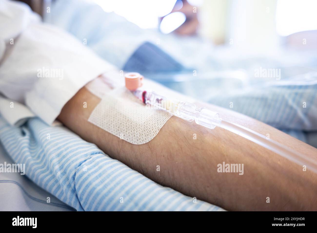 Cathéter veineux sur un patient avant une opération Banque D'Images