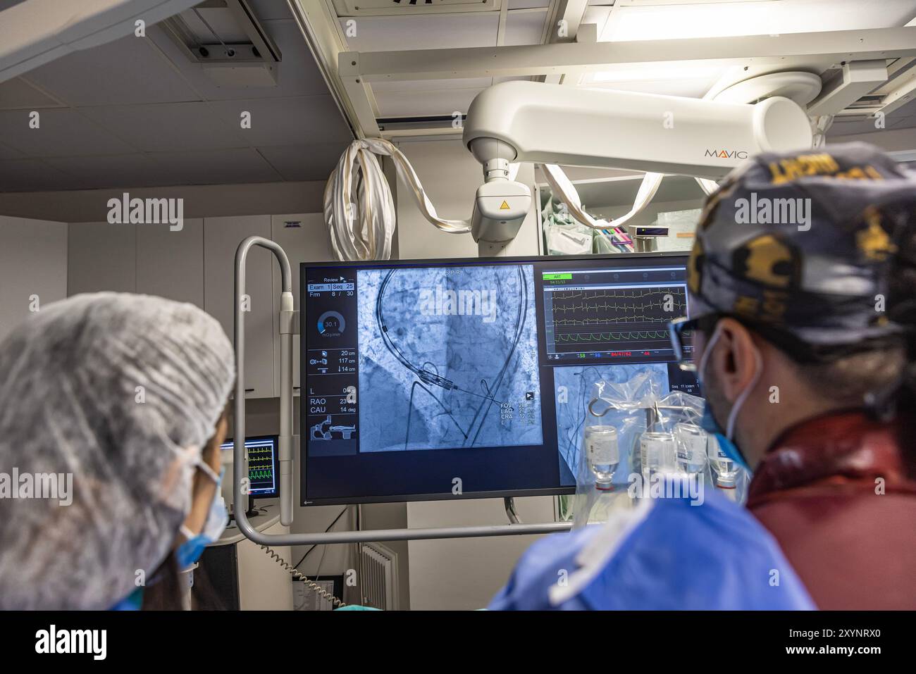 Istanbul, Turquie 29 février 2024 ; radiographie pour remplacement valvulaire avec valve mélodique. Vue d'une dysfonction valvulaire prothétique chez un patient atteint de mi Banque D'Images