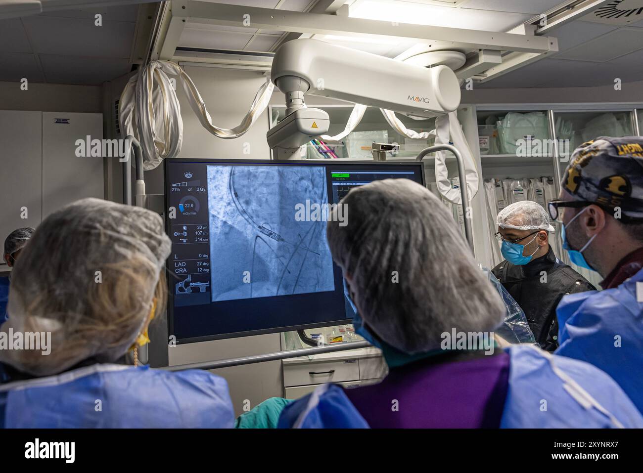 Istanbul, Turquie 29 février 2024 ; radiographie pour remplacement valvulaire avec valve mélodique. Vue d'une dysfonction valvulaire prothétique chez un patient atteint de mi Banque D'Images