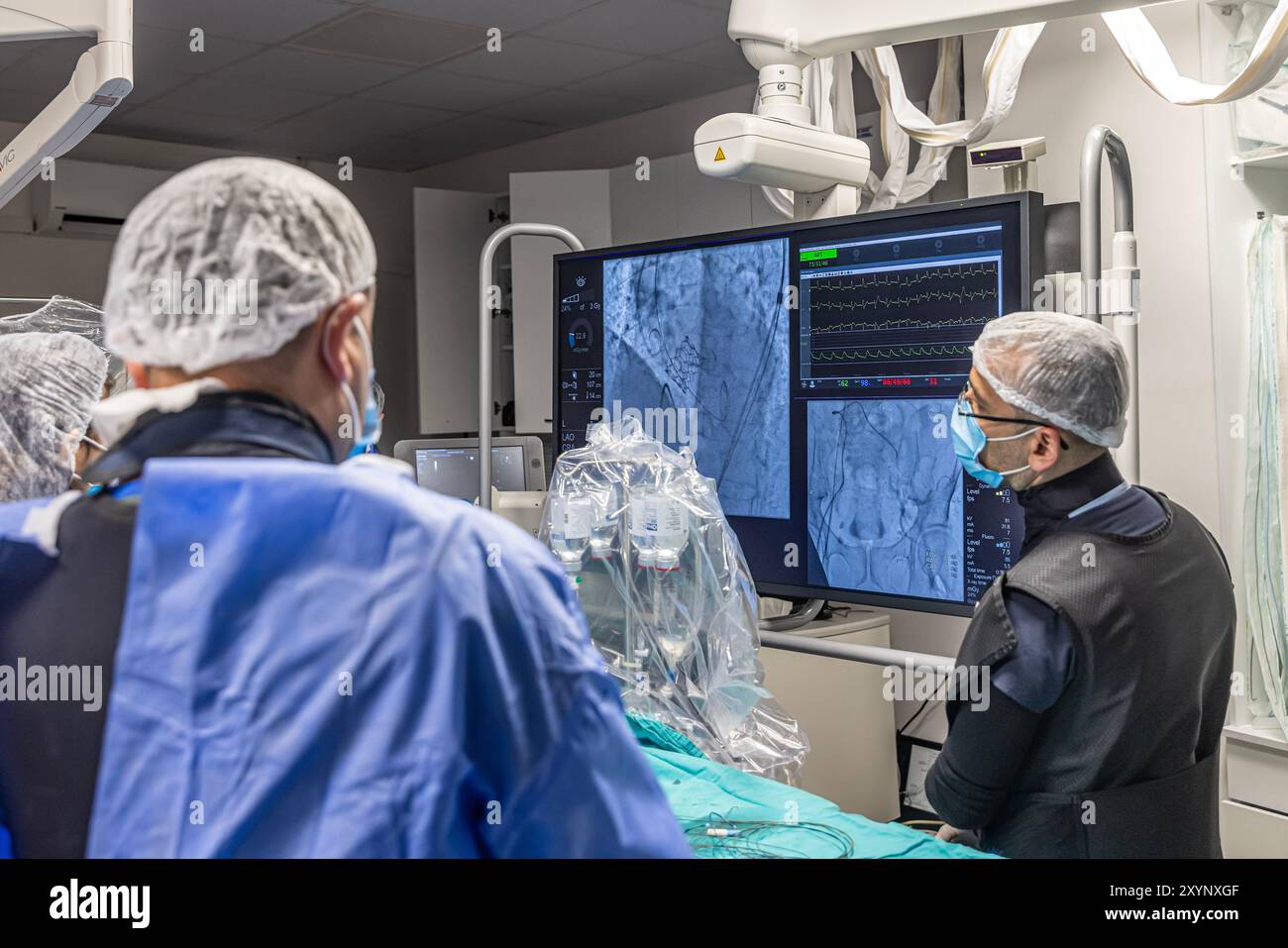 Istanbul, Turquie 29 février 2024 ; radiographie pour remplacement valvulaire avec valve mélodique. Vue d'une dysfonction valvulaire prothétique chez un patient atteint de mi Banque D'Images