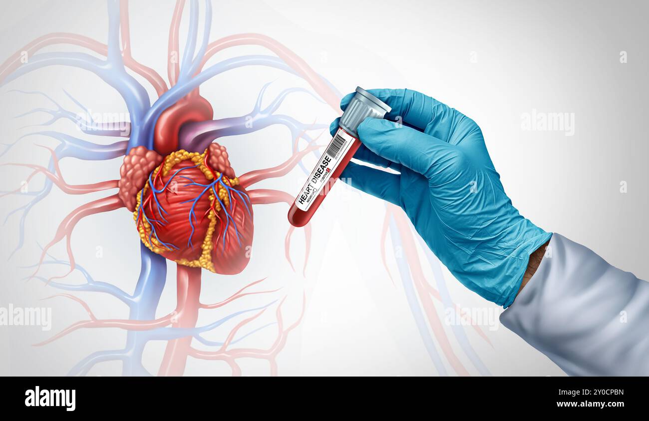 Cardiopathie test sanguin et diagnostic de santé cardiovasculaire en tant que médecin ou cardiologue scientifique avec un vile d'un échantillon à la recherche de biomarqueurs pour Banque D'Images