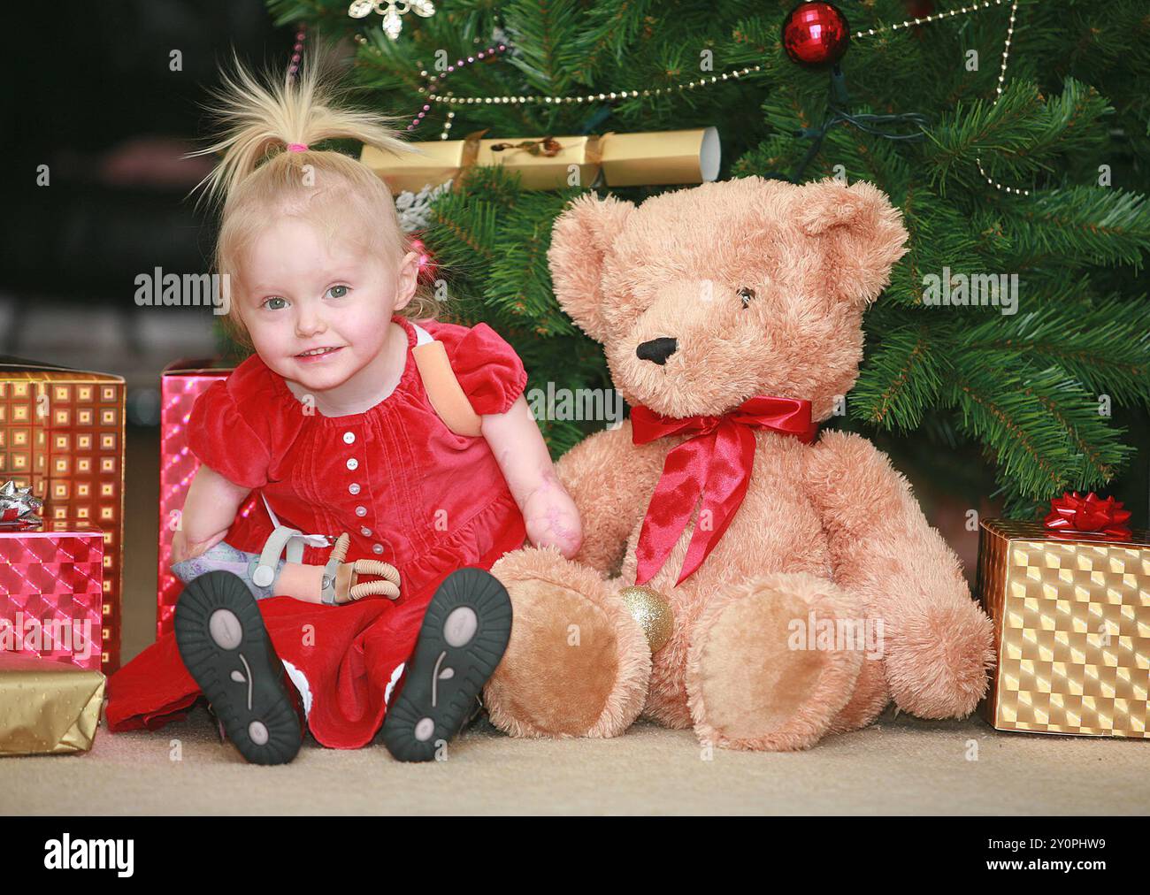 ELLIE CHALLIS AVEC SON OURS EN PELUCHE DE NOËL. Ellie Challis est devenue la plus jeune médaillée paralympique britannique à Tokyo 2020 lorsqu'elle a atteint le podium du 50 m dos S3 féminin lors de ses débuts aux Jeux - et elle continue de détenir un record du monde et plusieurs meilleures britanniques après quelques premières années impressionnantes en compétition internationale. LA JUMELLE ELLIE CHALLIS QUI A PERDU SES BRAS ET SES JAMBES À MENINIGITIS VIENT DE RECEVOIR UN NOUVEAU BRAS À TEMPS POUR NOËL. ELLE PEUT EMBRASSER SON OURS EN PELUCHE DE NOËL ET TIRER UN CRACKER POUR LA PREMIÈRE FOIS AVEC SON NOUVEAU BRAS. RAINHAM, ESSEX. L'IMAGE DOIT ÊTRE SOUS-TITRÉE WORLDWIDEFEATURE Banque D'Images