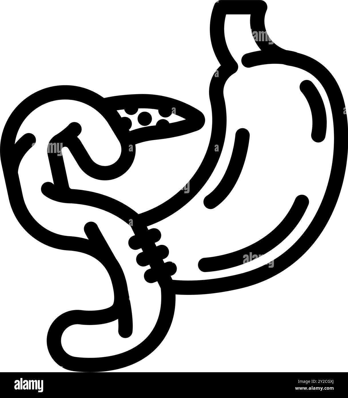 illustration vectorielle d'icône de ligne chirurgicale de procédure de whipple Illustration de Vecteur
