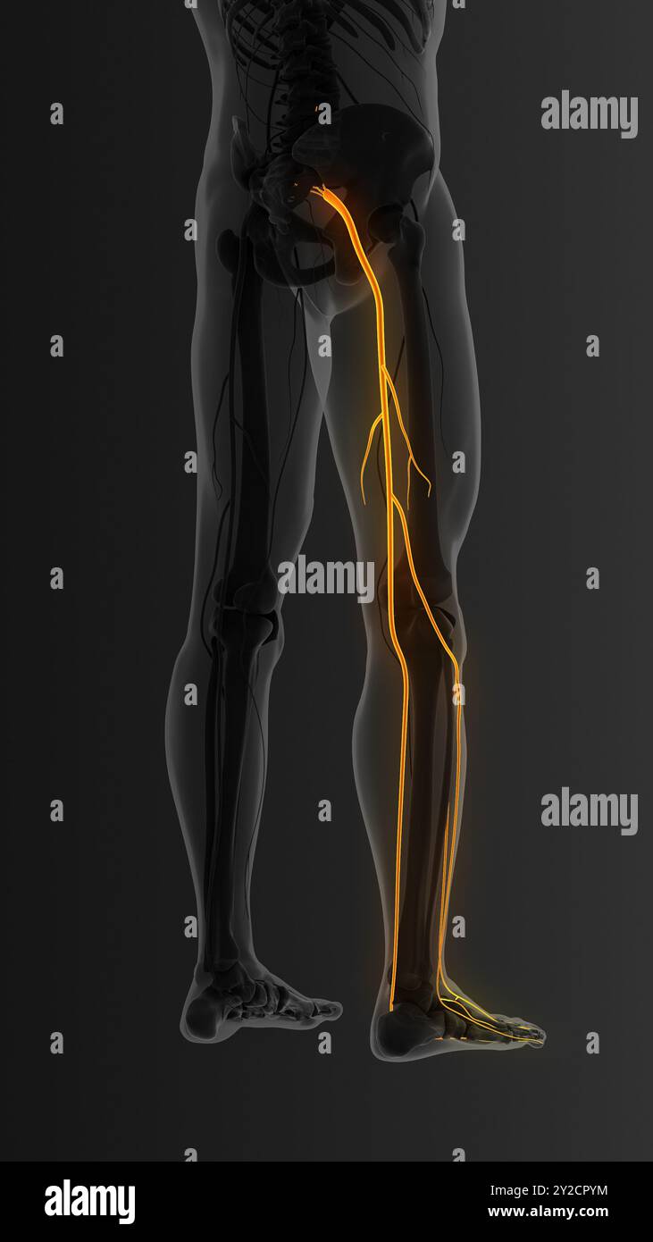 Douleur du nerf sciatique dans le bas du dos Banque D'Images