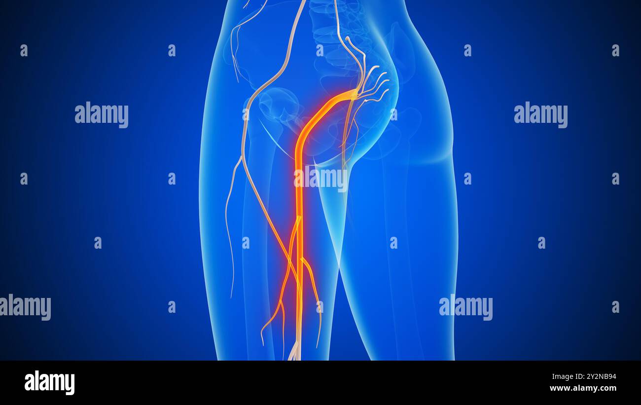 Le concept médical de la douleur du nerf sciatique Banque D'Images