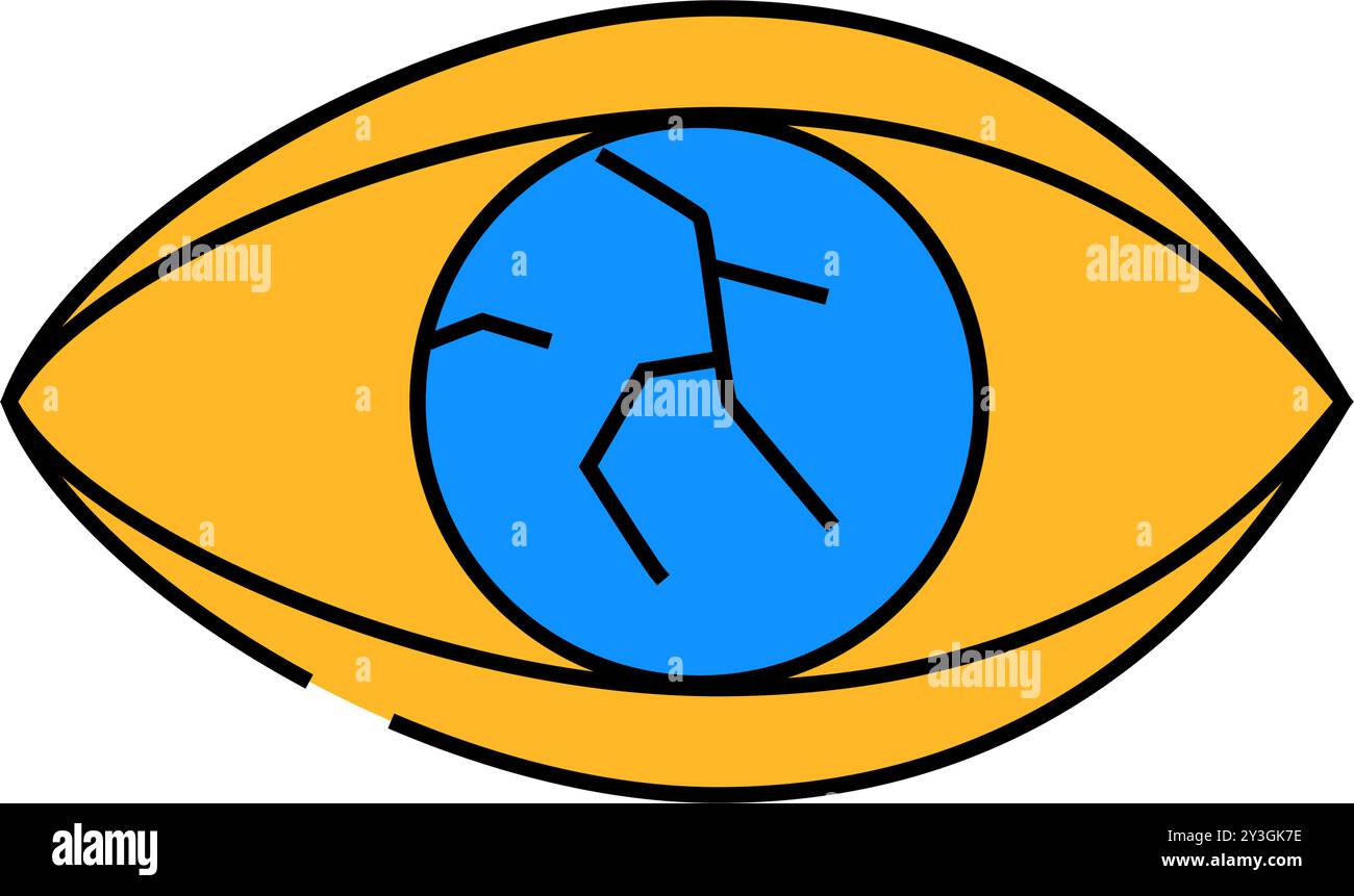 illustration couleur de l'icône ophtalmologie d'une lésion du cristallin Illustration de Vecteur