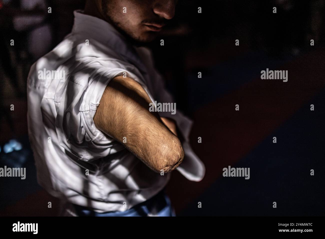 13 septembre 2024, Syrie, Idlib : une photo mise à disposition le 19 septembre 2024 montre Ismail Al-Shmaly montrant son membre amputé. L’homme de 16 ans, déplacé d’Alep, a perdu sa main droite lors d’une frappe aérienne syrienne en 2015. Il a commencé à pratiquer le karaté à l'âge de 10 ans pour contester sa blessure de guerre et est depuis devenu l'un des joueurs de karaté les plus en vue dans le nord de la Syrie. Photo : Anas Alkharboutli/dpa Banque D'Images