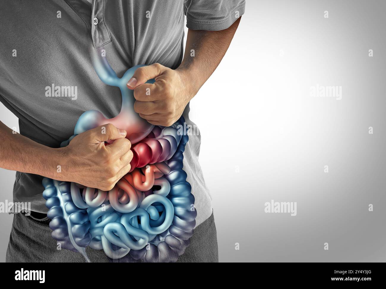 Symptômes du SCI et douleurs d'estomac ou maux d'estomac avec une douleur du système digestif douloureuse comme une maladie abdominale ou syndrome du côlon irritable et ulcères repr Banque D'Images