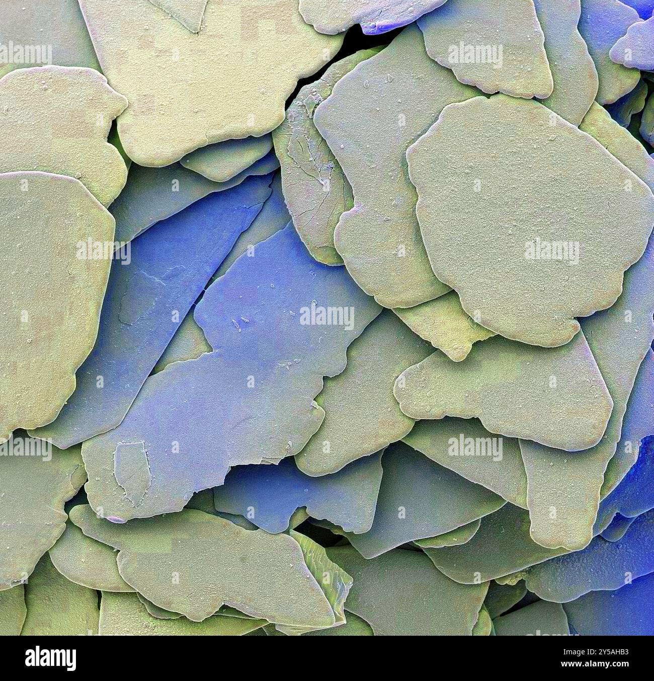 Particules de gommage du visage, SEM. Micrographie électronique à balayage coloré (MEB) des particules trouvées dans la lotion de gommage du visage grand public. Les grandes flocons sont des particules de silice qui ne mesurent que quelques micromètres de largeur chacune. Les flocons agissent comme des agents exfoliants pour éliminer les cellules mortes de la peau lorsqu'ils sont appliqués sur le corps. Agrandissement x 20000 à 10cm de large. Banque D'Images