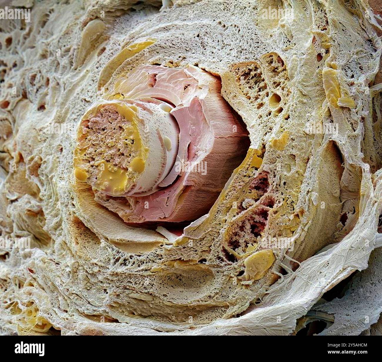 Cils. Micrographie électronique à balayage coloré (MEB) d'une fracture à travers un cil. Un cheveu pousse à partir d'un follicule dans la couche sous-jacente de la peau (le derme) entourant l'œil. La partie du cheveu qui dépasse de la peau est composée de tissus morts et de la protéine kératine. Les cils protègent l'œil des débris. Ils sont sensibles au toucher, fournissant ainsi un avertissement qu'un objet est près de l'œil qui est alors fermé par réflexion. Grossissement : x1600 lorsqu'il est imprimé à 10 centimètres de large. Banque D'Images