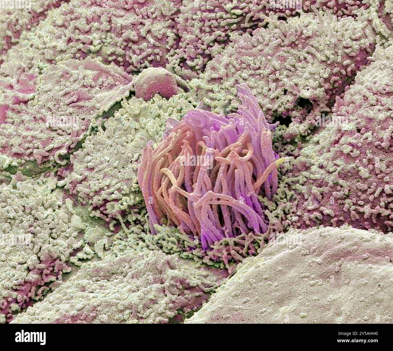 Utérus (stade mi-sécrétoire). Micrographie électronique à balayage couleur (MEB). Grossissement : x3000 lors de l'impression à 10 cm de large. Banque D'Images