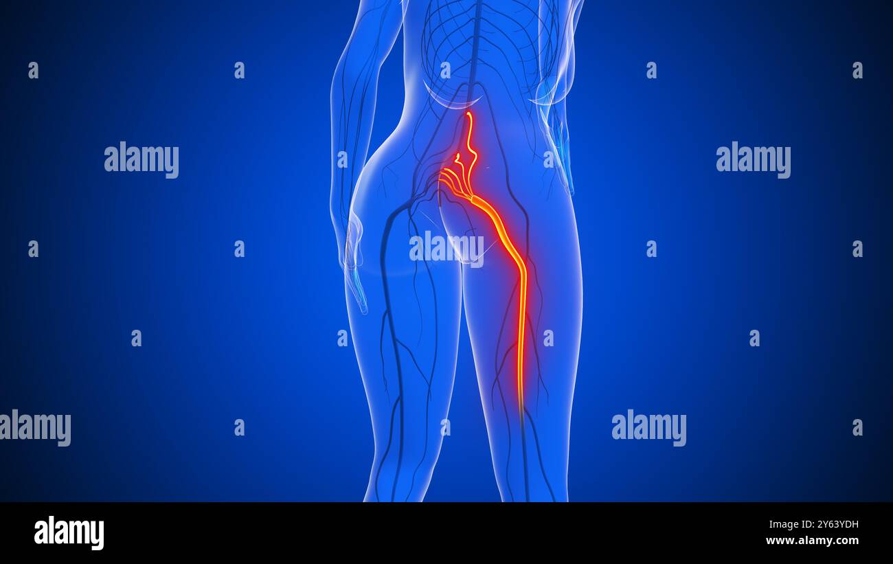 Douleur du nerf sciatique dans le corps humain Banque D'Images