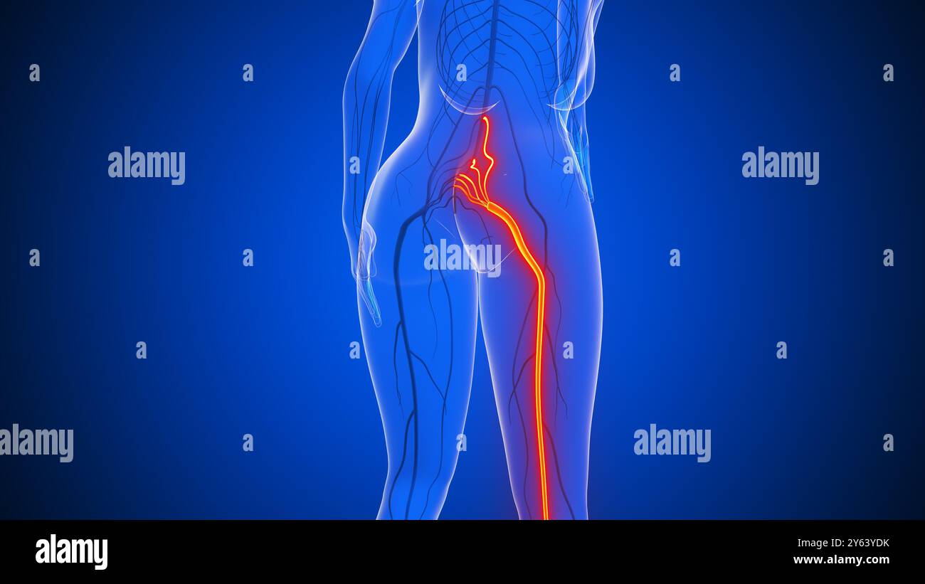 Douleur du nerf sciatique dans le corps humain Banque D'Images