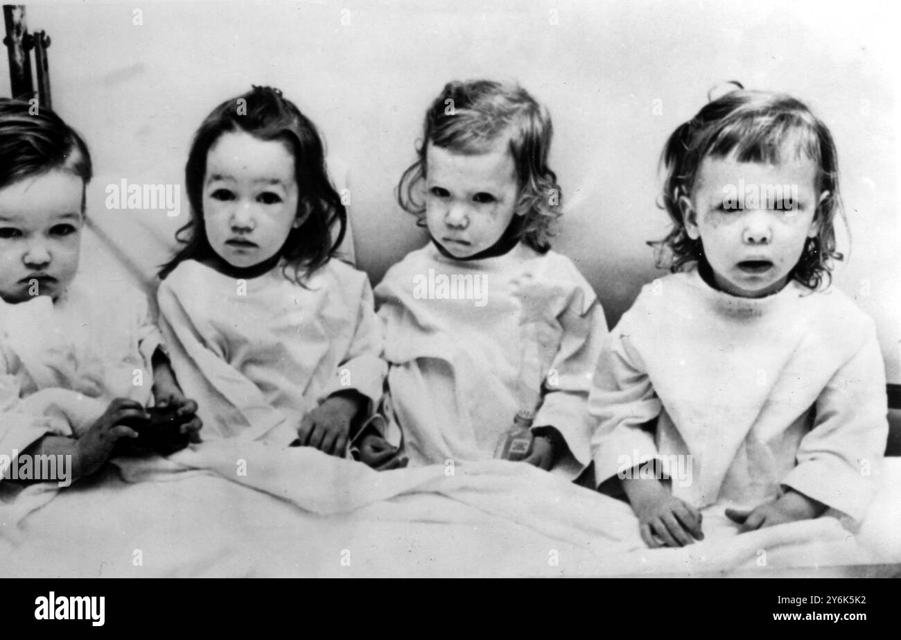 Milwaukee Wisconsin Woesome pilule avaleurs Twins Kathy et Sally Krusczynski Snack sur des comprimés d'aspirine et Randall et Therese Schiltz une heure plus tard ont pris des pilules contre les maux de tête les deux ensembles de jumeaux ont été admis à l'hôpital municipal de Johnstone et ont dû avoir une pompe à estomac. Les faits suivants recueillent pour les dossiers les deux ensembles de jumeaux ont deux ans , ils ont tous les deux les mêmes anniversaires ; en fait ils sont nés à une heure l'un de l'autre le 17 décembre 1955 , ils étaient tous les deux un mois en avance sur le calendrier . 1958 Banque D'Images