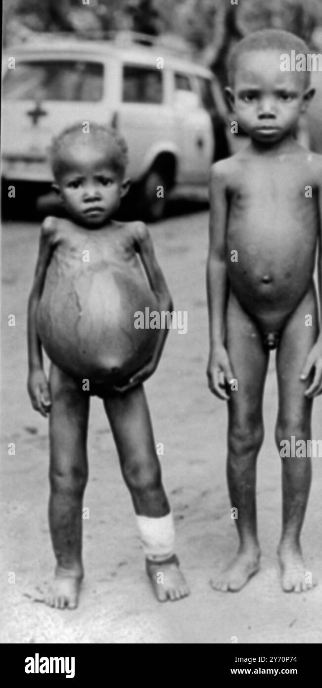 Ces enfants affamés de l'Etat sécessionniste du Biafra au Nigeria ont été photographiés vers la fin du mois dernier dans la région d'Umuahia . Deux des enfants souffrent de Kwashiorkor , une desiase de carence en protéines qui se montre dans l'estomac gonflé , les membres rétrécis , les plaies de jambe et les cheveux blancs . La maladie coûte la vie à des milliers d'enfants chaque semaine. 2 août 1968 Banque D'Images