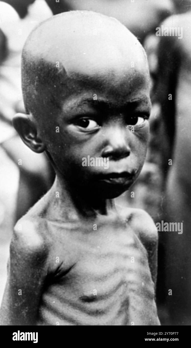 Enfant affamé trouvé par l'UNICEF ( Fonds des Nations Unies pour l'enfance ) , victime de la guerre civile qui sévit actuellement au Nigeria . 21 juin 1968 Banque D'Images