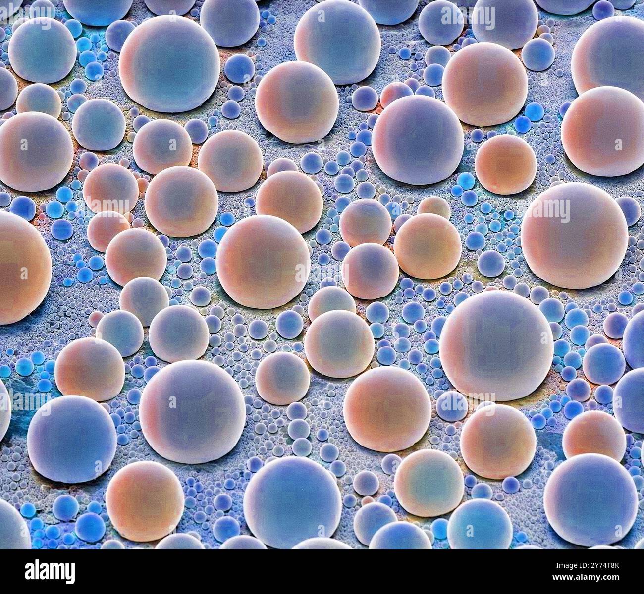Étain sur échantillon de résolution carbone, micrographie électronique à balayage coloré (MEB). Il s'agit d'une dispersion de sphères d'étain, dans la gamme de taille 10 - 100 nm, sur un substrat de carbone. Idéal pour la correction de l'astigmatisme, il est également recommandé pour une utilisation dans les mes employés dans l'industrie des semi-conducteurs. Grossissement : x 500 lorsqu'il est imprimé à 10 centimètres de large. Banque D'Images