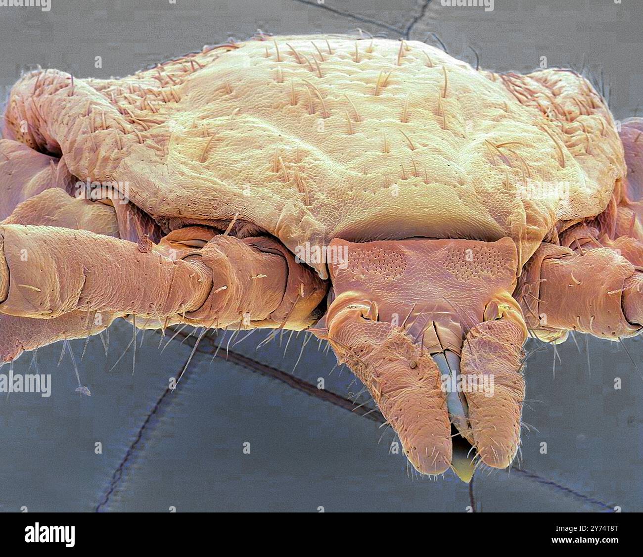 Tique, micrographie électronique à balayage couleur (MEB). Les tiques (superfamille des Ixodoidea) sont de petits arachnides. Ce sont des ectoparasites qui se nourrissent du sang des mammifères, des oiseaux et parfois des reptiles et des amphibiens. Ils transmettent plusieurs maladies, dont la maladie de Lyme, la fièvre à tiques du Colorado, la fièvre récurrente et une forme de méningo-encéphalite, ainsi que d'autres maladies. Grossissement : x150 lors de l'impression de 10 centimètres de large. Banque D'Images