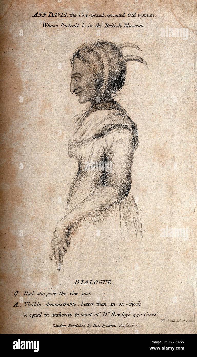Illustration vintage d'Ann Davis, une femme avec la variole et les cornes poussant hors de sa tête. Gravure en pointillés par T. Woolnoth, 1806. Banque D'Images