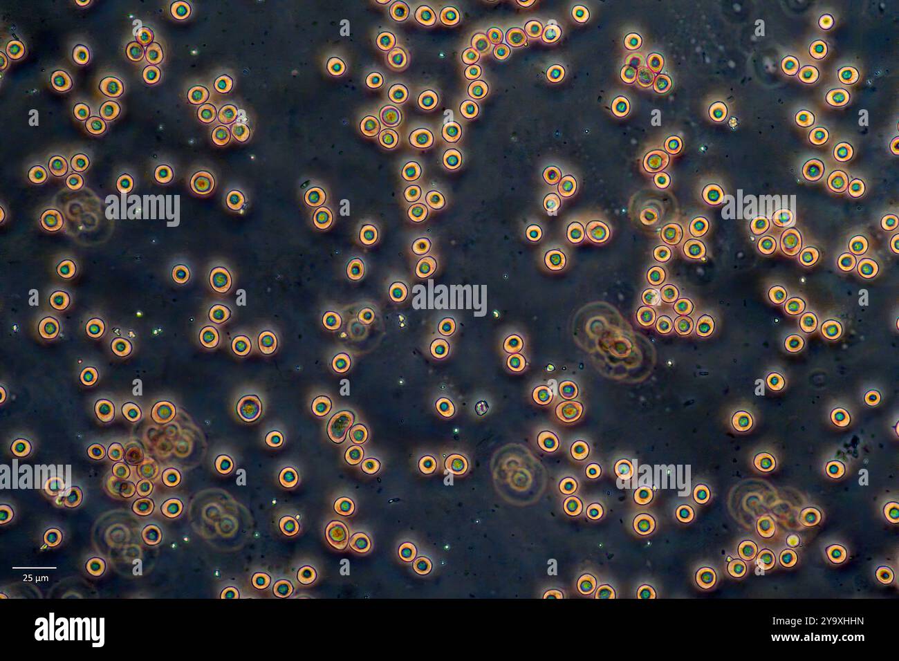 Spores de la moisissure de boue Didymium squamulosum. Banque D'Images