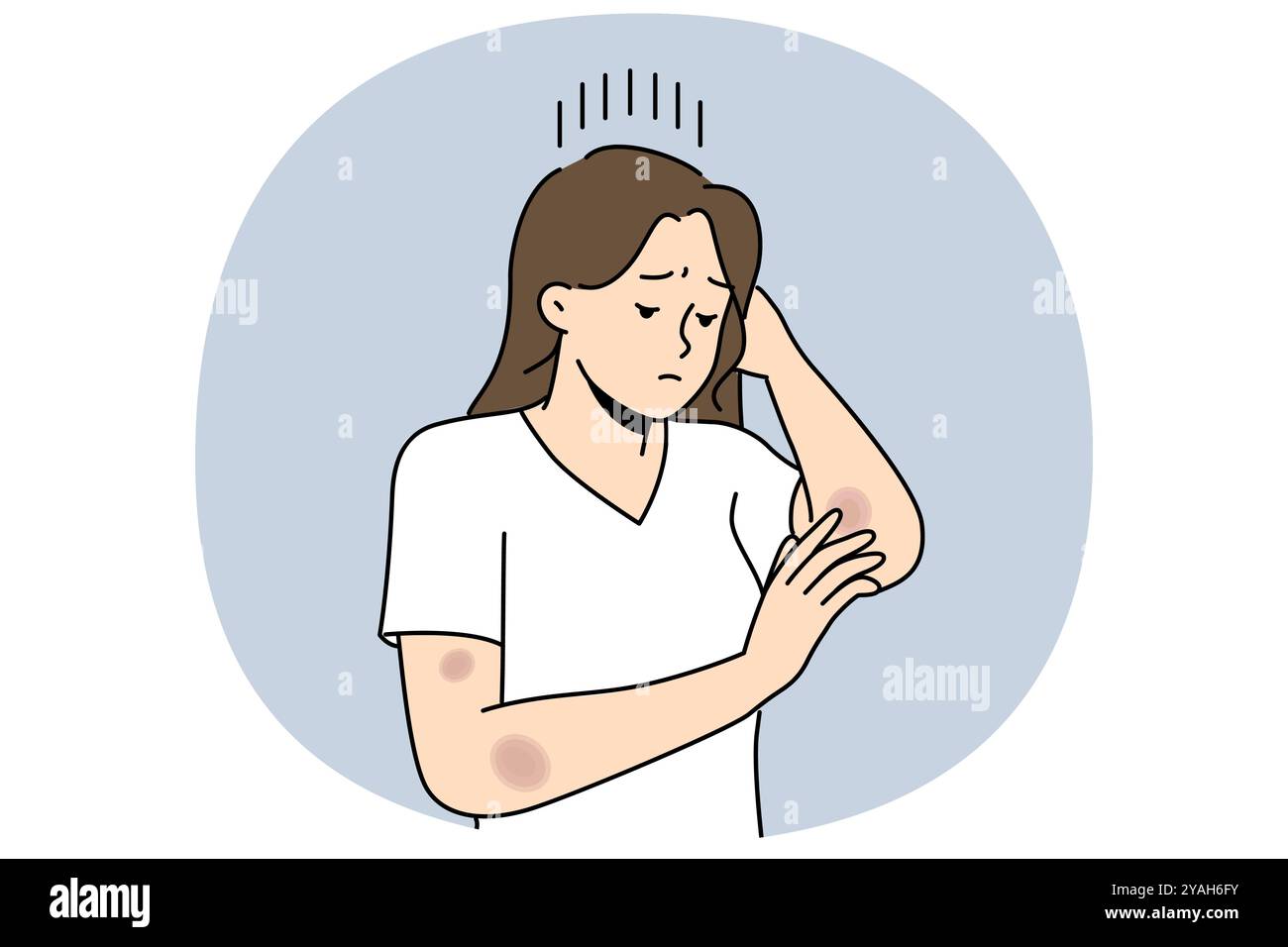 Femme avec des ecchymoses sur les bras est triste et regarde les abrasions reçues après une chute ou un accident sur la route. Les filles déprimées ont besoin d'onguent curatif pour les ecchymoses et les blessures laissées en raison de la violence domestique Illustration de Vecteur